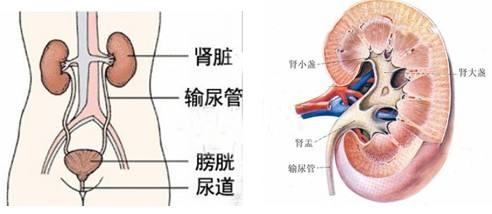 肾积水的治疗