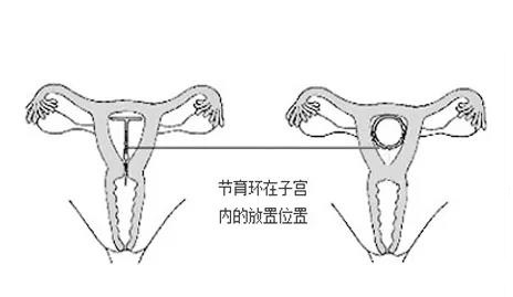 “我不想戴套”——“哭完了吗？哭完我就挂了