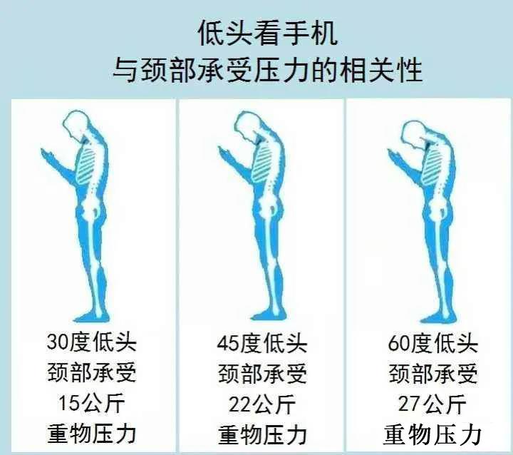 20岁的年龄，50岁的颈椎？ 一名合格的打工人不能忽视的身体“警报”