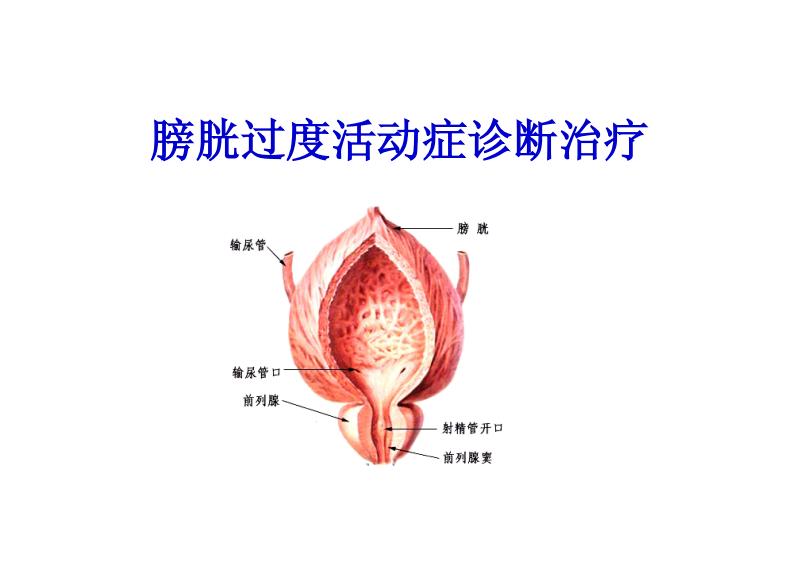 毛起势上厕所，他还有个科学的名字叫膀胱过度活动症