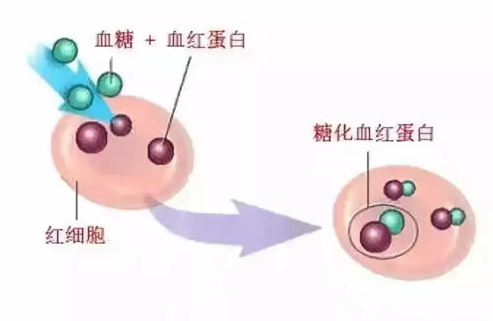 关于糖尿病降糖，你必须知道这些