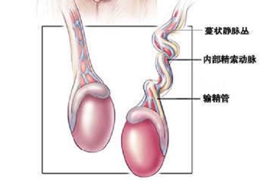 精索扭转的病情、治疗介绍