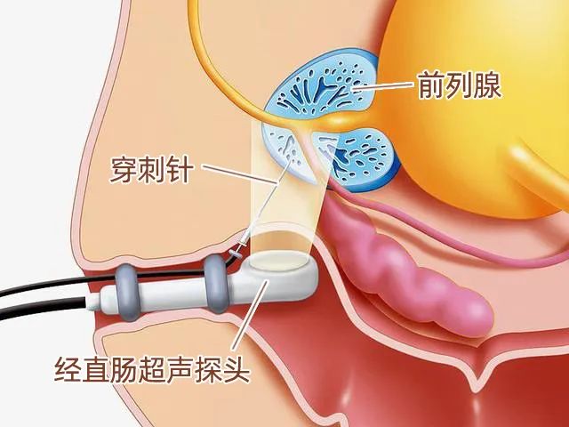 医生：3招让医生：3招让