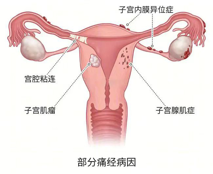 最讨厌的“人” 竟然是大姨妈？